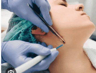 Other Laser Treatment